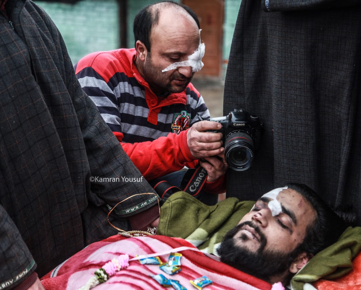 kanran yusuf pic pellet journo attack 2019-01-23 at 3.58.57 pm